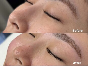 アイロンボーイ(IRONBOY)/艶肌お顔全体WAX