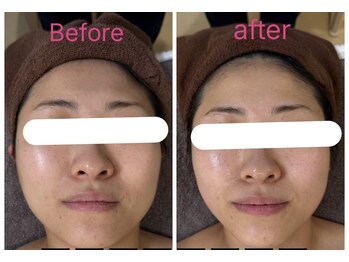 ラヴィエールフローラ(Laviere Flora)/フェイシャルコース