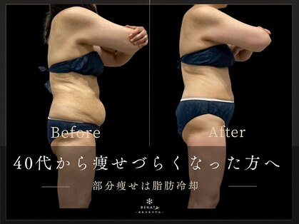 レナータ 銀座店(RENATA)の写真