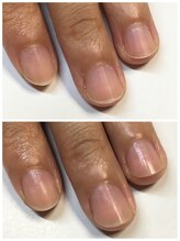 ネイルサロンアンドスクール アイビー(IVY)/ウルウル地爪