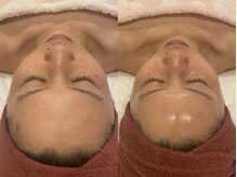 ナンバー19(N°19)/小顔も叶う♪