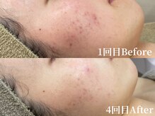 アンバー(amber)の雰囲気（様々なお肌悩みに徹底的サポート◎！美肌へ導きます★）