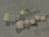 <フット>定額ミドル￥8900