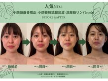 ウィズリリナ 新横浜(with Lilina.)/感動のお客様ビフォーアフター★