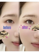 ニコ 渋谷(nico.)/LED/アンドヘルシー80本