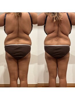 ミ ライト(m light)/