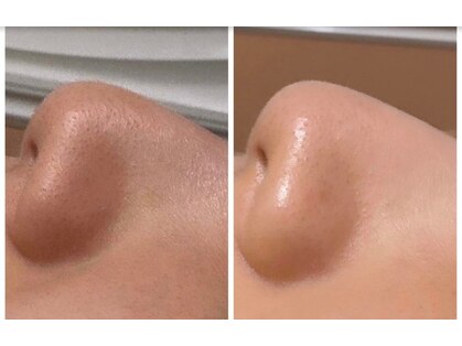 アルティメイト(Ultimate)の写真