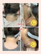 ビューティサロン ココモ(Cocomo)/before・after