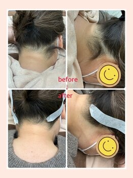 ビューティサロン ココモ(Cocomo)/before・after