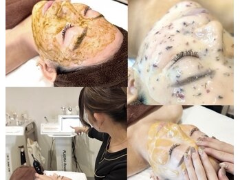 レア(le'a)の写真/最新韓国肌管理★貴女のお悩みに合わせたオーダーメイド施術♪肌トラブル改善プログラムで徹底的に美肌へ♪