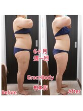 痩身 脱毛専門店 グレイスボディ 柏本店(Grace Body)/痩身　症例写真4