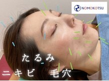 ノモコツ 千林院(NOMOKOTSU)の雰囲気（《気になる不良姿勢に対応◎》とにかく結果にこだわる！）