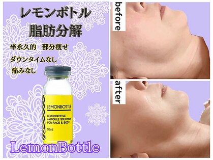 カピリナスパ(Ka.Pilina Spa)の写真