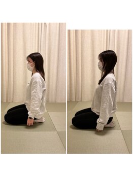 ツリー鍼灸整骨院 吹田店(TREE鍼灸整骨院)/姿勢が気になる女性増えてます