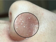 イデアルボーテ/ごっそり毛穴ケア