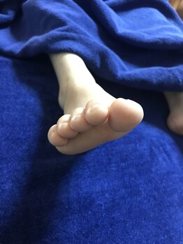 チチ(Chichi)/足の指、曲がっていませんか？