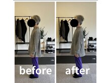 カワル整体 長嶺院/猫背