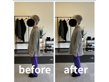 カワル整体 長嶺院/猫背