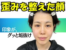 ナチュラルビューティーフェイス 横浜(NBF)/全身美容矯正[横浜/横浜市/小顔]