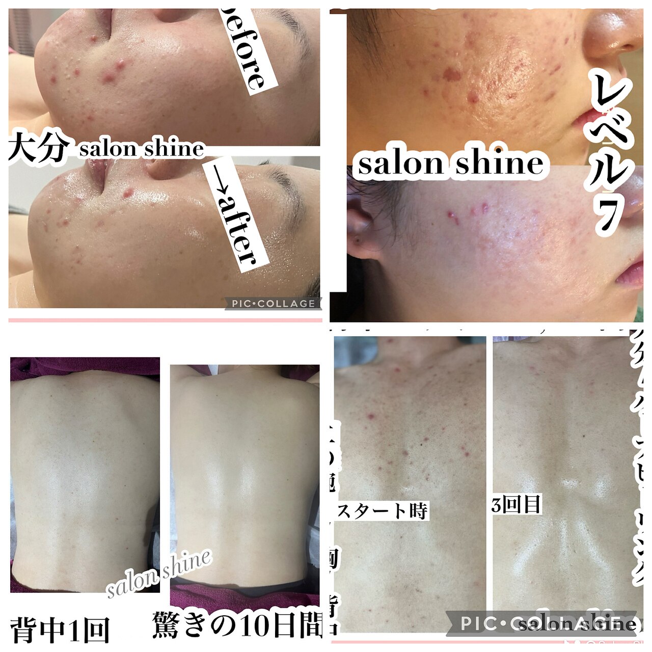 サロンシャイン(Salon Shine)｜ホットペッパービューティー