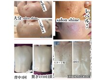 サロンシャイン(Salon Shine)
