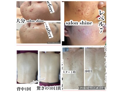 サロンシャイン(Salon Shine)の写真