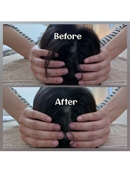 ぷめはな整体/頭のむくみの変化♪