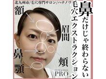 ハナノワ(花のWA)/毛穴エクストラクション施術箇所