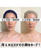 お顔の研究所/ビフォーアフター写真♪