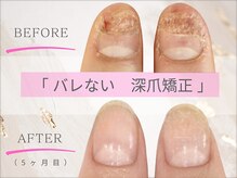 リファーレ(RIFARE)