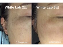 三美創ビューティースタジオ 富山店/シミ改善にホワイトラボ