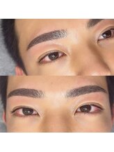 フィーノ(fino.)/Mens脱毛