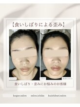 イチカ 仙川店( ichika)/食いしばりによる左右差