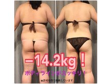 ボディエステティック アクアオーラ 富山店/やせたい場所が落ちました