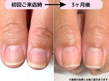 カピリナ(Ka Pilina)/最強のネイルケア