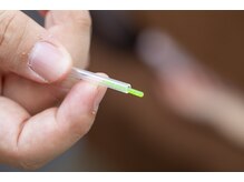 わらび鍼灸院/「負担最小限」のこだわりの鍼