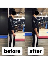 カワル整体 上通り院/opeをしたけど痛い