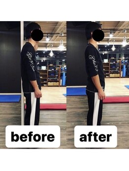 カワル整体 上通り院/opeをしたけど痛い