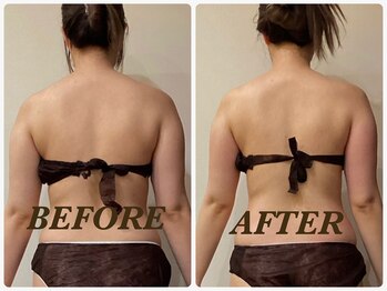 プリマ 栄店(Prima)/【2回施術】　BEFORE＆AFTER