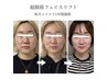 40代たるみ！顔筋トレマシン 50分 ★ヘッド付き★