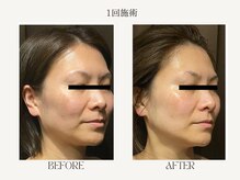 サロンドベル(salon de Belle)の雰囲気（【小顔フェイシャル】フェイスラインを綺麗にたるみ激変♪）