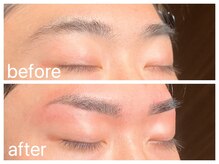 クラシックス(CLASSICS)/メンズwax脱毛