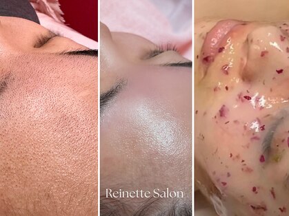 レネットサロン(Reinette Salon)の写真