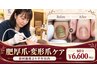 2回目以降（前回施術から半年以内）【肥厚爪・変形爪・副爪】ケア 60分 ￥6600