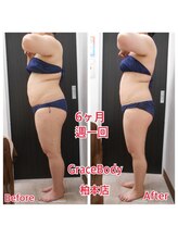 痩身 脱毛専門店 グレイスボディ 柏本店(Grace Body)/痩身　症例写真5