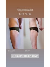 レナトゥス 銀座(Renatus)/1ヶ月でスッキリ☆【痩身/銀座】