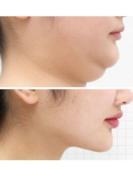 ビハダ(BeHADA)/#圧倒的なサイズダウン