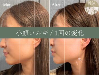 ヴィヴィアン 名駅店(骨気&Relaxation Vivian)/小顔コルギ