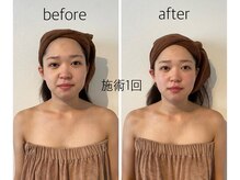 バンブー(bamboo)/ビフォーアフター