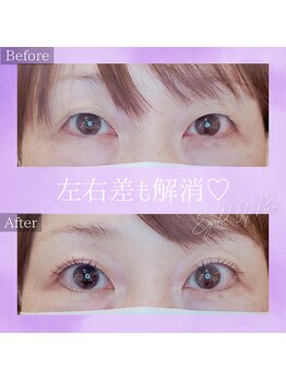 コトリ(kotori)/アイリッドアップパーマ